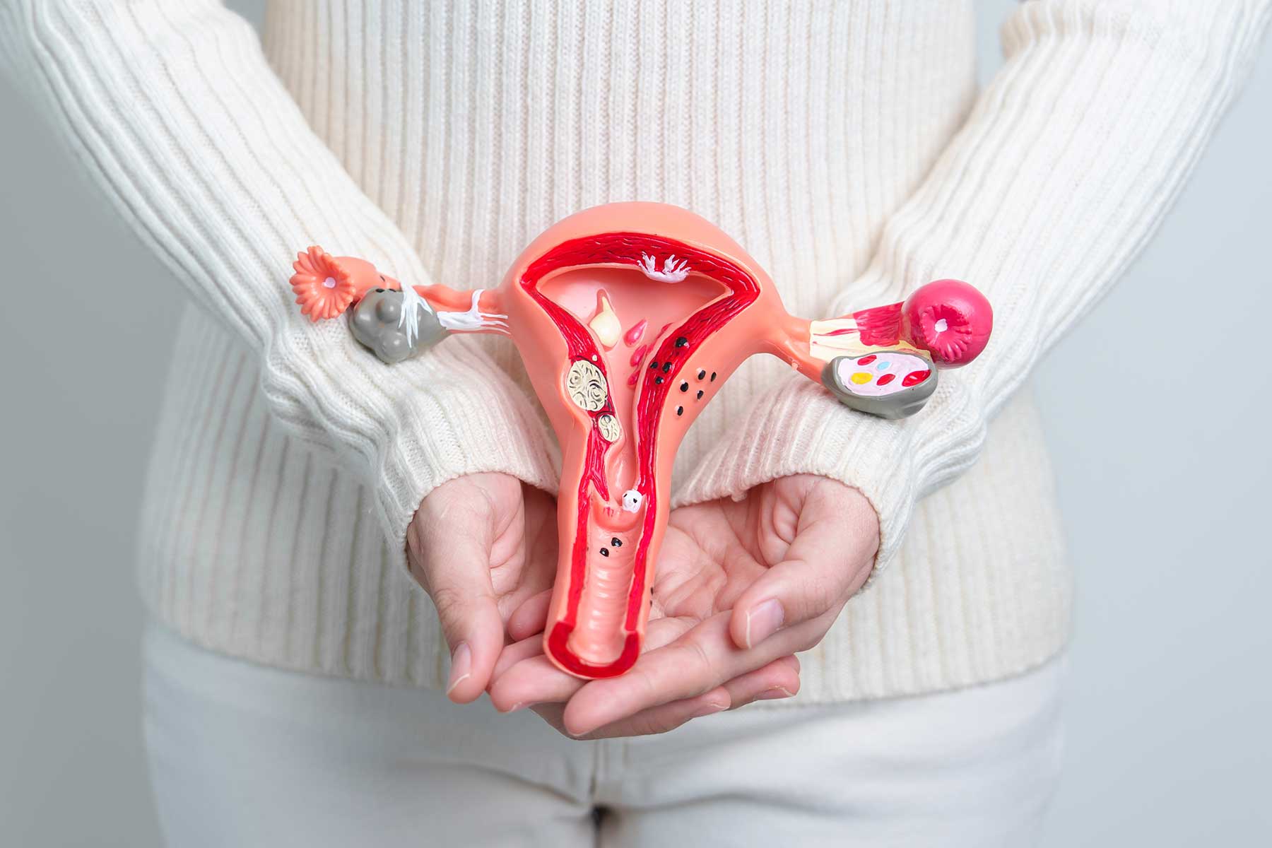 ACN Foundation partnership with Endometriosis Australia ACN Foundation partnership with Endometriosis Australia