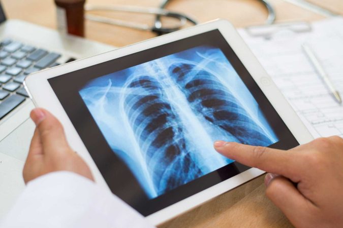 Australia’s new lung cancer screening program: What nurses need to know