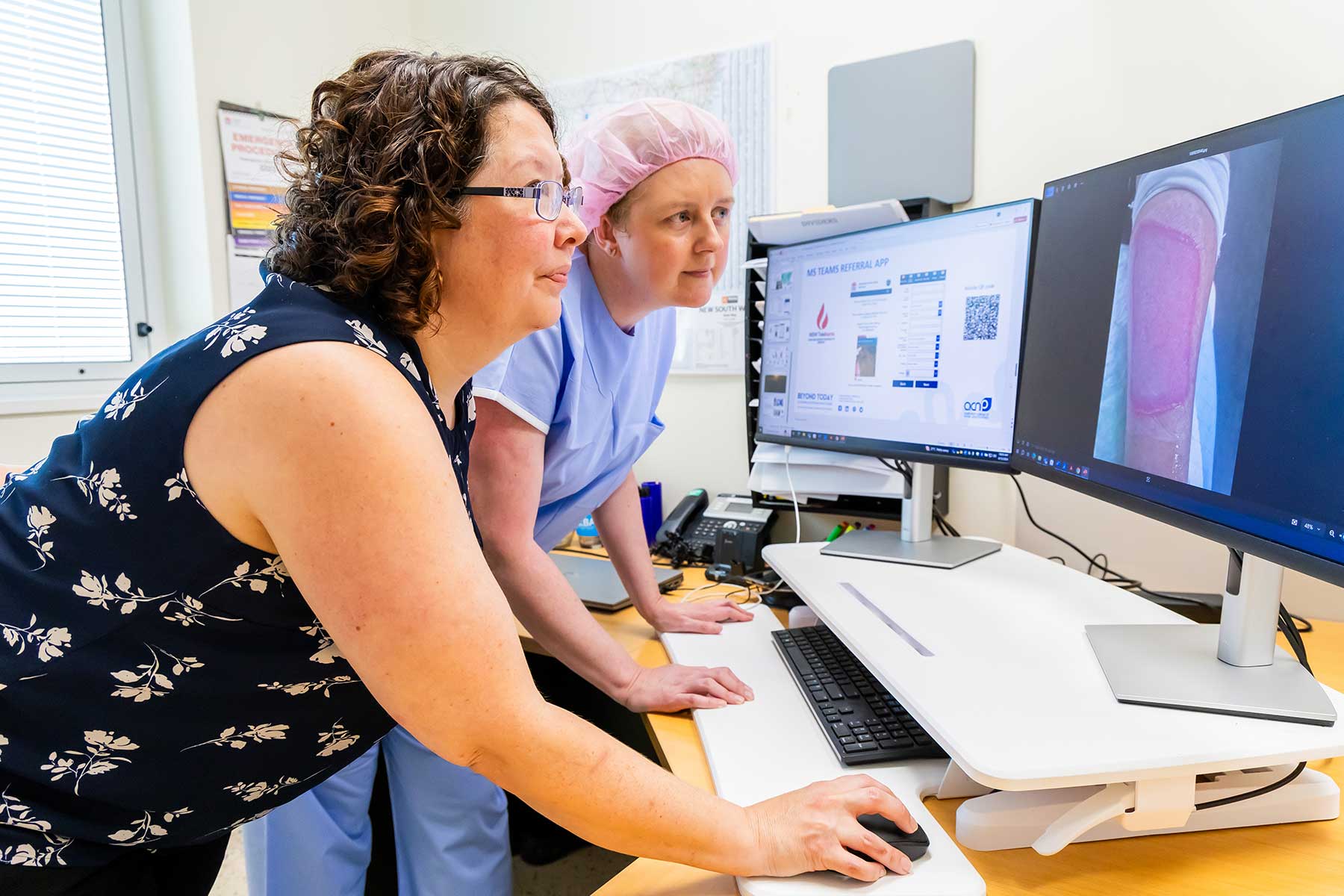 Nurse practitioner-led virtual burns service: Bringing burns care to the bush Nurse practitioner-led virtual burns service: Bringing burns care to the bush